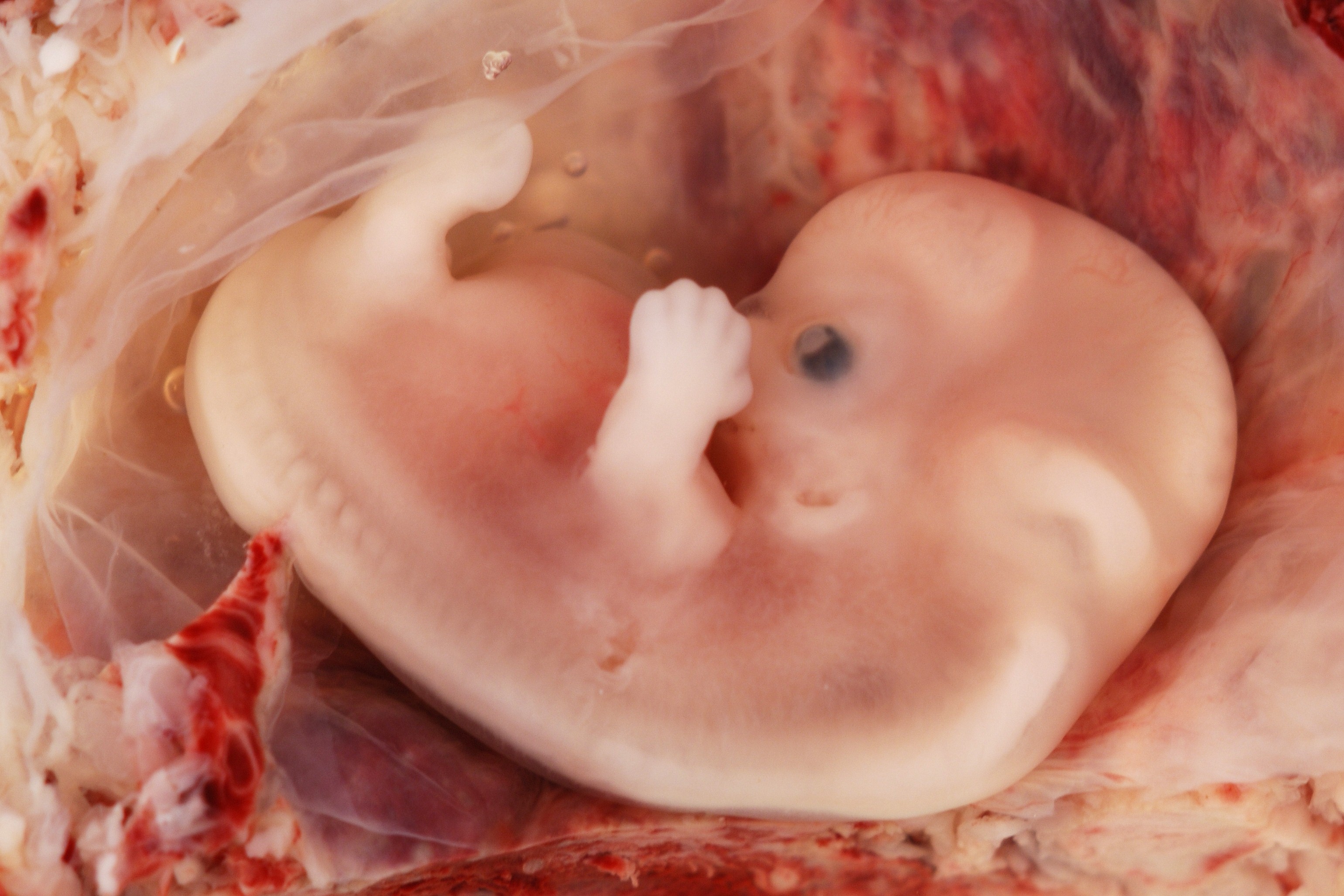 9 неделя видео. Эмбрион на 8 неделе беременности. Фото 8 недель беременности фото плода. Плод на 8 неделе беременности.
