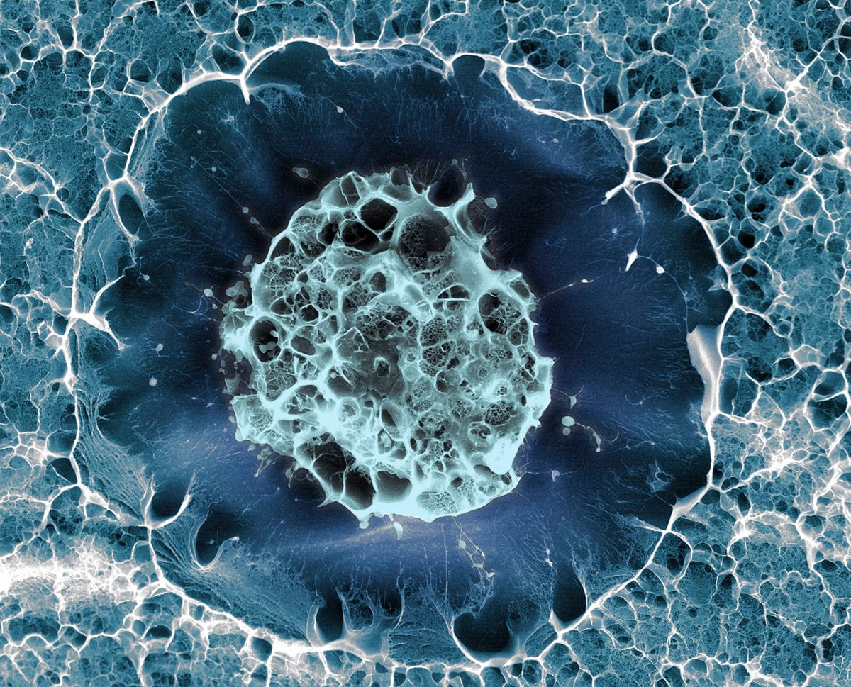 Человеческая клетка под микроскопом фото