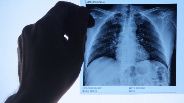 Угроза детям: у уборщицы свердловского роддома нашли туберкулёз