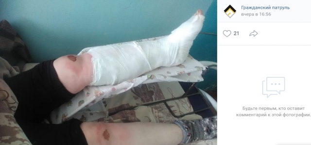 Жертва паводка: в Омской области сломавшая ногу женщина ползла до дома 6 км