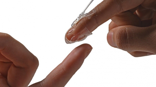 Искусственная кожа