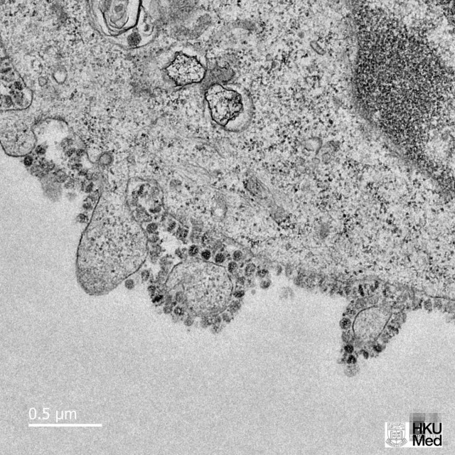 Ученые впервые сфотографировали процесс размножения коронавируса