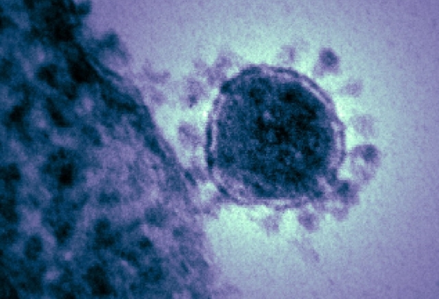 Момент прикрепления коронавируса к рецептору клетки сцепка S белка «короны» вируса и рецептора