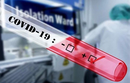 В Калужской области подтвердили 51 положительный тест на коронавирус