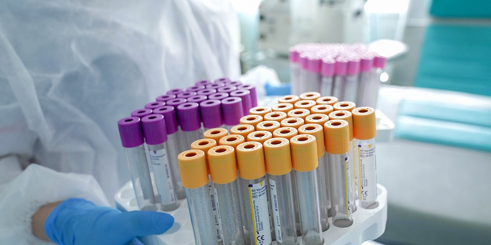 США передали Албании 29 тысяч тестов на коронавирус