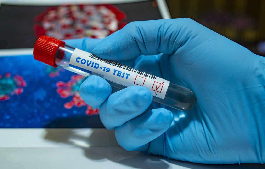 В Калужской области отмечено снижение числа заражённых коронавирусом