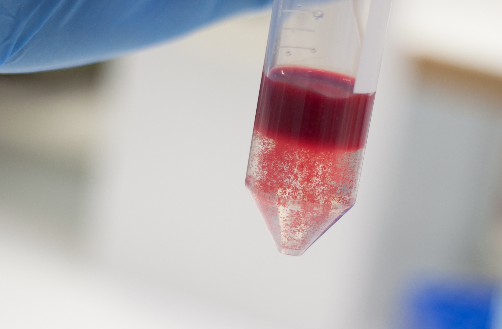 В Ленобласти из-за пандемии остро не хватает донорской крови