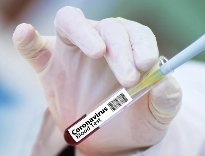 В Калужской области за сутки выявили 166 носителей коронавируса