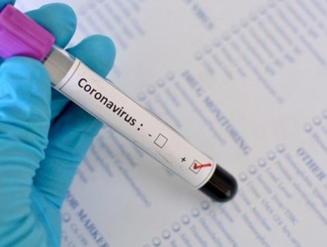 В Калужской области за сутки выявили 155 носителей коронавируса