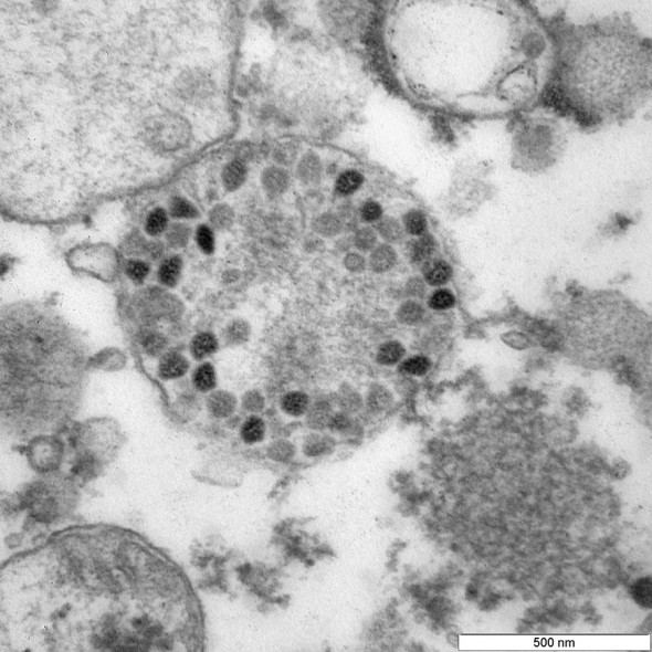 Штамм коронавируса «Омикрон» под микроскопом