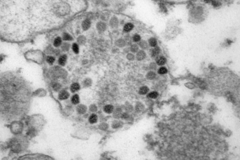 Штамм коронавируса «Омикрон» под микроскопом