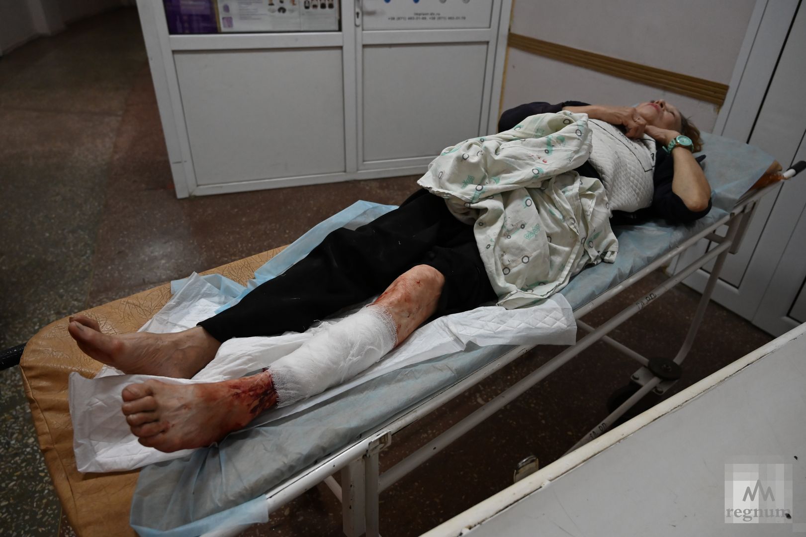 Женщина, пострадавшая от обстрела Донецка
