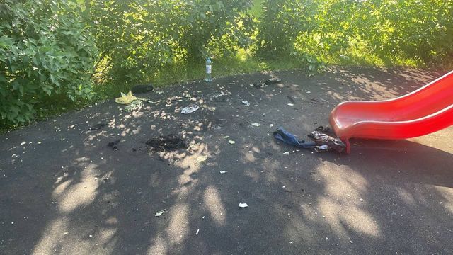 В Москве 14-летний подросток получил ожоги 80% тела, играя с бензином